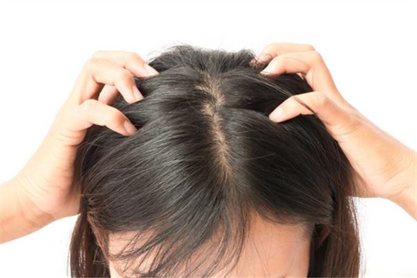 女性梦中见头皮屑覆盖头部的解读