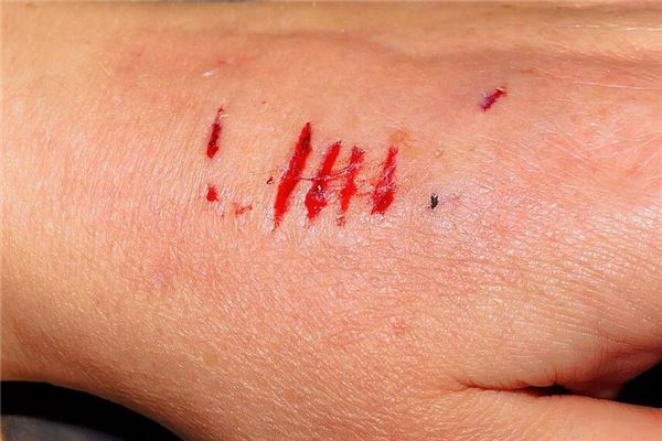 女性左手流血梦境预示解析